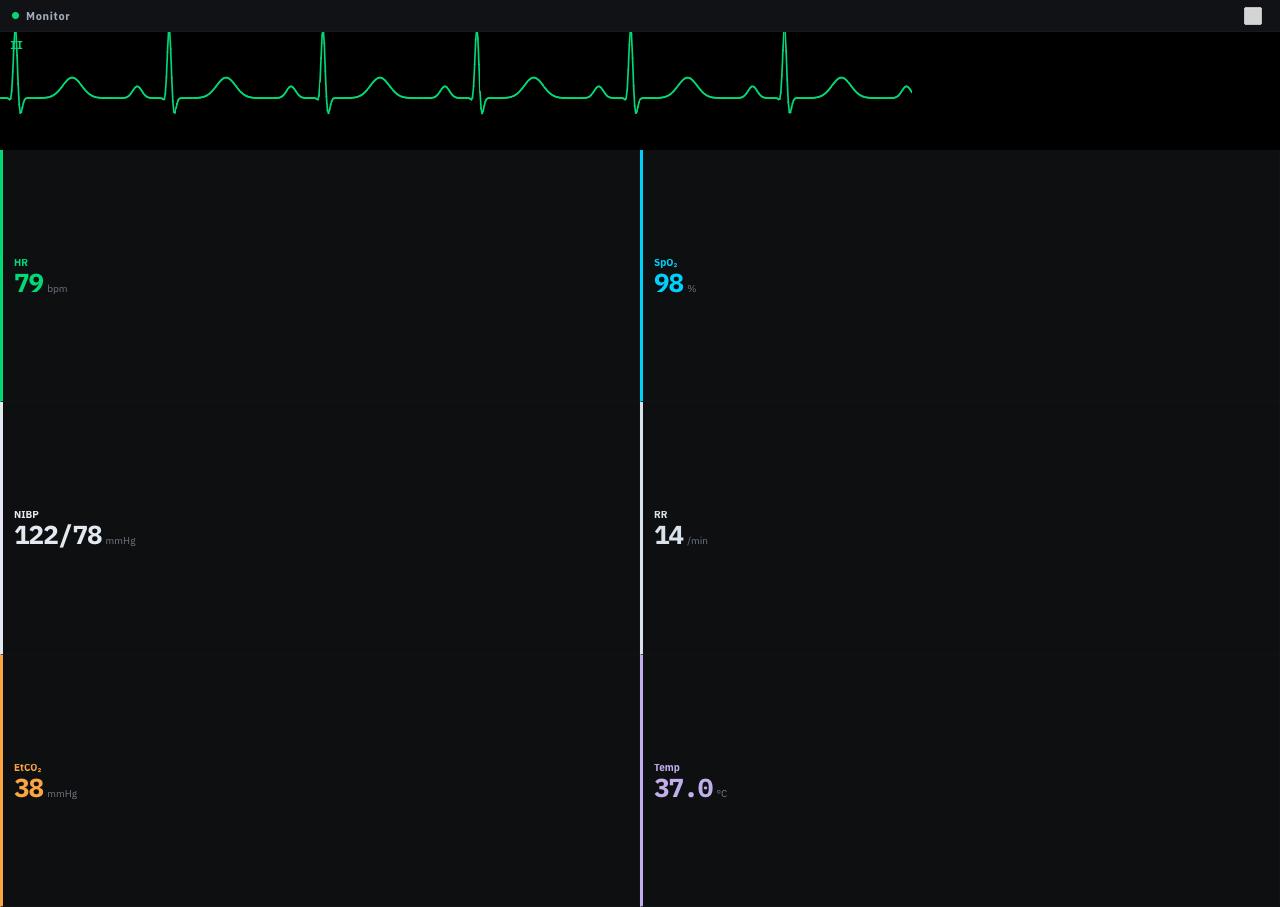 ResusSim patient monitor: sinus ECG waveform, heart rate 79, SpO₂ 98%, NIBP 122/78, EtCO₂ 38
