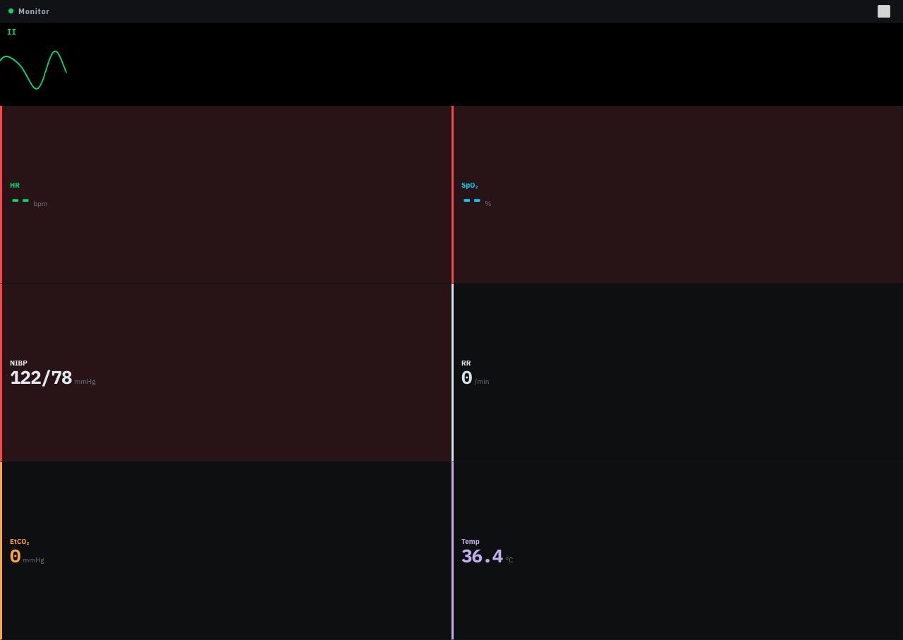 Patient monitor in VF arrest with alarm states
